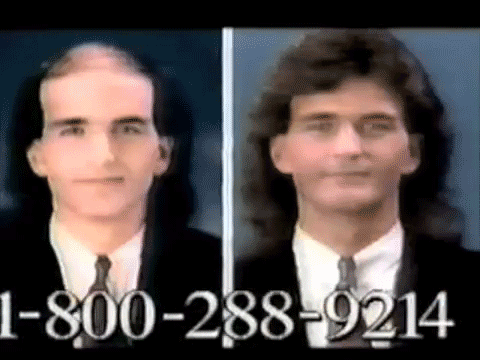 Before and after images of a man who has regrown his hair